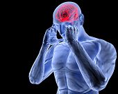 stock photo of cerebellum  - a man with a headache under x - JPG 