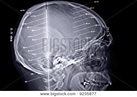 Ct+scan+brain+anatomy