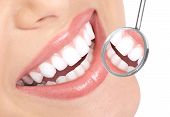 pic of smile  - Healthy woman teeth and a dentist mouth mirror - JPG 