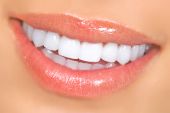 stock photo of smile  - Smiling woman mouth with great teeth - JPG 