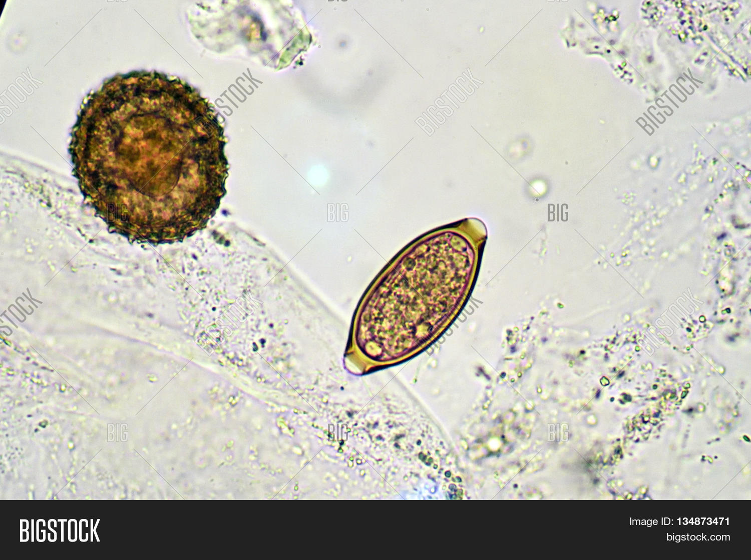 Does Steam Cleaning Kill Roundworm Eggs at Nicole Haycraft blog