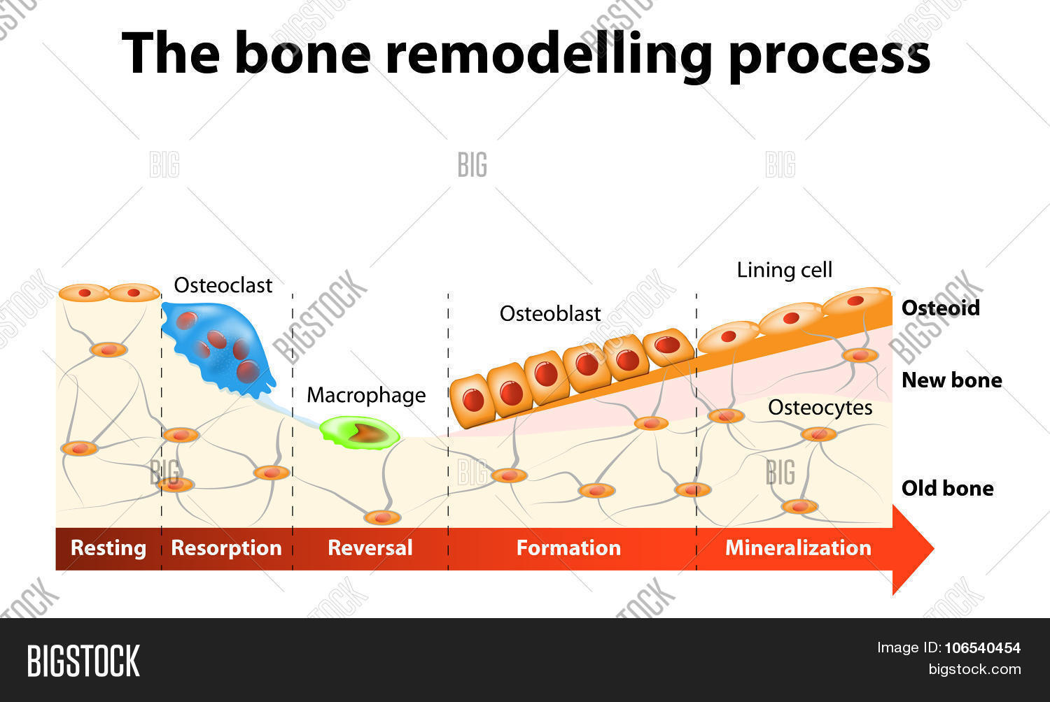 Bone Remodelling Process Vector & Photo Bigstock