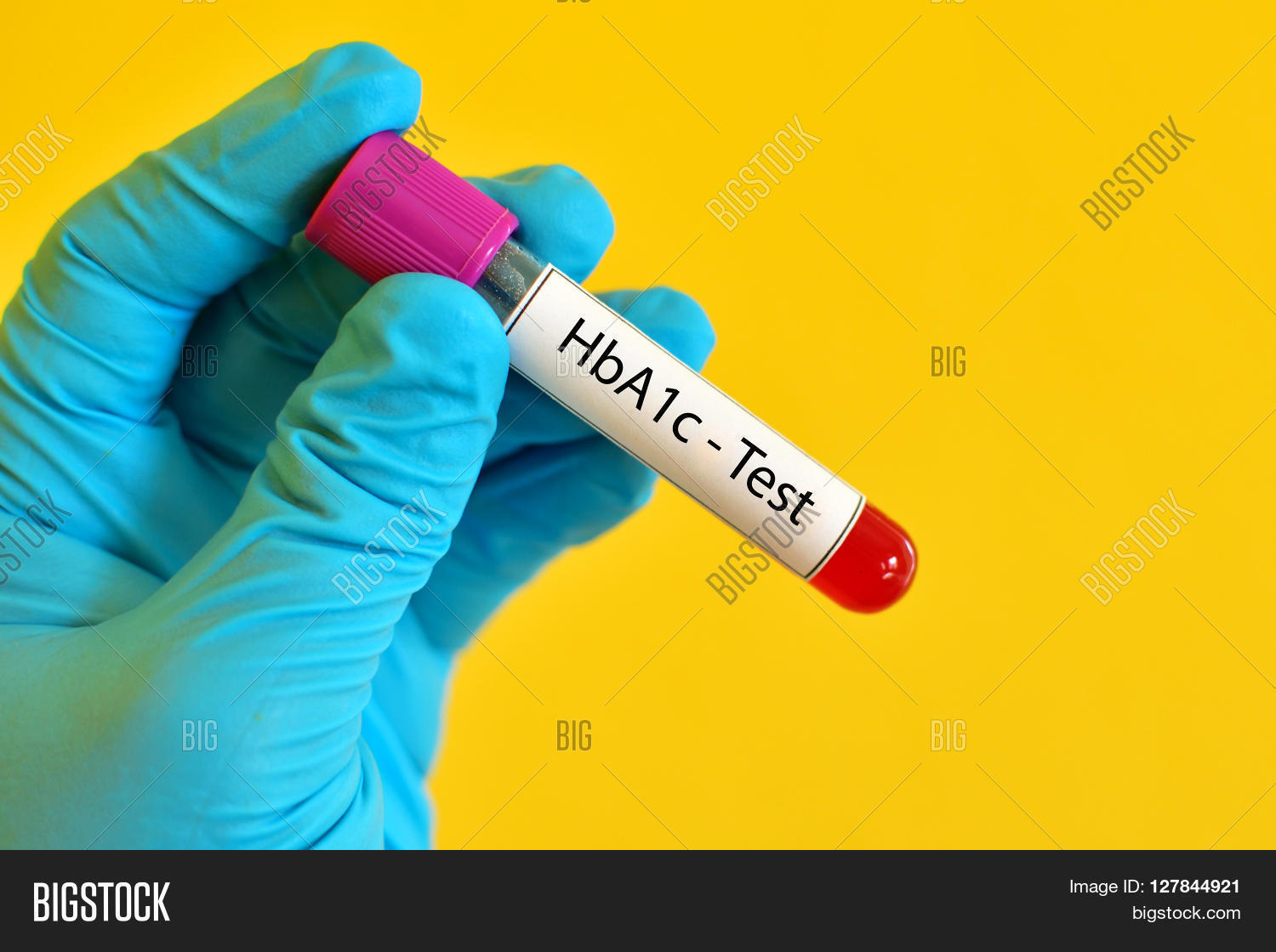 Test Tube Blood Sample Hemoglobin Image & Photo Bigstock