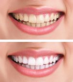 stock photo of health  - whitening  - JPG 