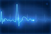 image of normal  - Electrocardiogram - JPG 