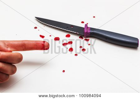 A cut of finger while cooking.