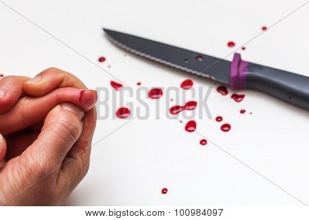 A cut of finger while cooking.
