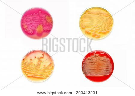 Mixed of bacteria colonies in various petri dish