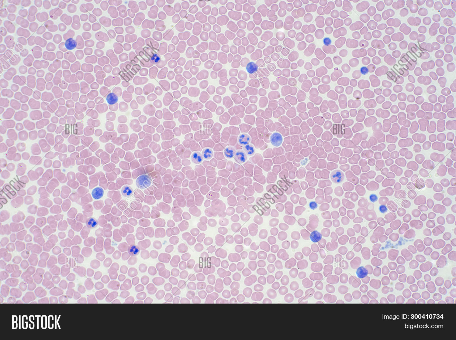 Get Wallpaper Blood Cells Under Image Photo Free Trial Bigstock HD