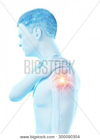 3d rendered medically accurate illustration of a man having a painful shoulder