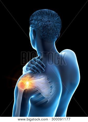 3d rendered medically accurate illustration of a man having a painful shoulder