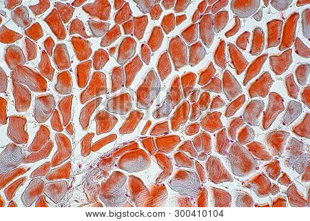 Cross Section Muscle Skeleton Micro Preparation Samples- Section (tissue) Under Microscope View. His