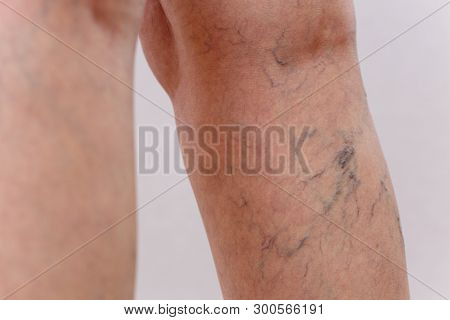 Elderly woman in white panties shows cellulite and varicose veins on a light isolated background. Co