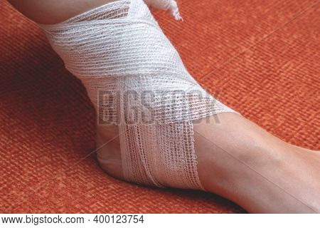 A Young Woman At Home Bandages Her Foot And Lower Leg With A Bandage. Side View, Close-up