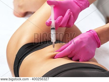 A Doctor Of Aesthetic Cosmetology Makes Lipolytic Injections To Burn Body Fat On A Woman’s Stomach A
