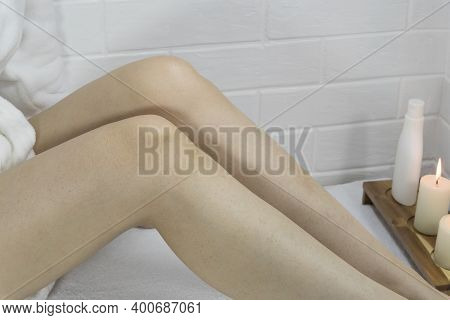 Slim Female Legs. Home Skin And Body Care. Irritation After Hair Removal. Strawberry Legs, Massage, 