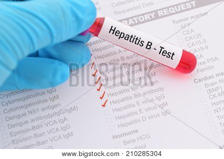 Blood sample with requisition form for hepatitis B virus test