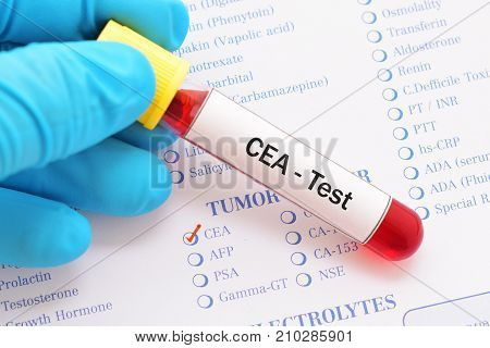 Blood sample with requisition form for CEA test