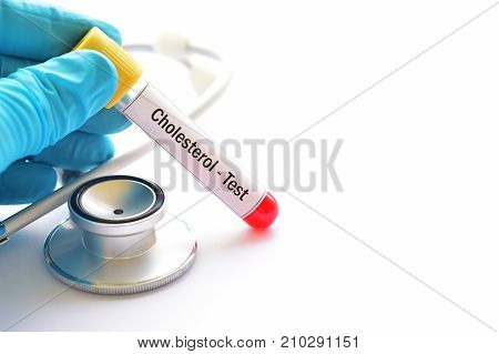 Test tube with blood sample for cholesterol test