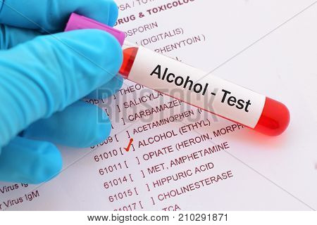 Blood sample with requisition form for alcohol test