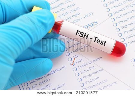 Blood sample with requisition form for follicle stimulating hormone (FSH) test
