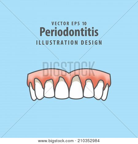 Periodontitis Human Gum Inflammation Illustration Vector On Blue Background. Dental Concept.