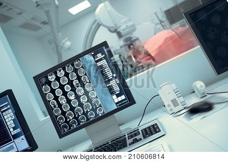 Roentgen scanning of patient with neurological condition.