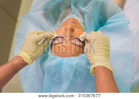 Aged Woman Doing Mesothreads And Thread Lifting, Cosmetology. Cosmetic Procedure To Eliminate Signs 