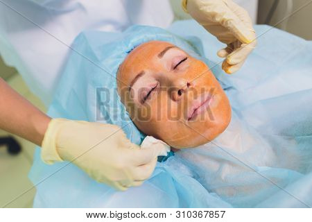 Aged Woman Doing Mesothreads And Thread Lifting, Cosmetology. Cosmetic Procedure To Eliminate Signs 