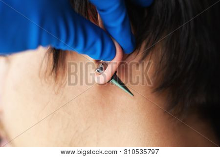 Stretching Ears For Larger Diameter Tunnels,piercer Hand Inserts The Piercing In The Ear Close-up