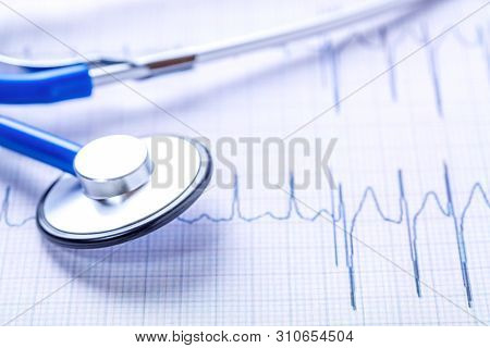 Examine The Heart Concept. Blue Stethoscope And Cardiogram Chart Close Up Image