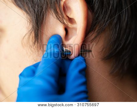 Piercing And Stretching The Ears With Medical  Blue Gloves. Increase The Diameter Of The Ear Tunnels