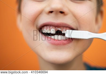 Boy Without Milk Upper Tooth.