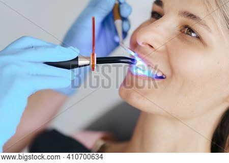 Photopolymer, Dentist Fixes A Seal To A Young Patient Woman, Photopolymer Lamp