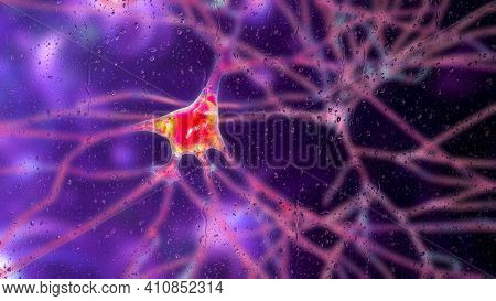 Neurons In Dementia, Conceptual 3d Illustration. Destruction Of Neurons And Neuronal Networks