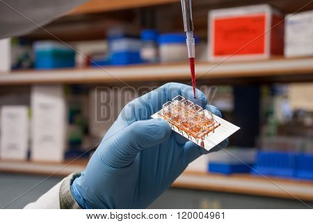 Scientist Uses Pipette During Cells Research In Scientific Laboratory.