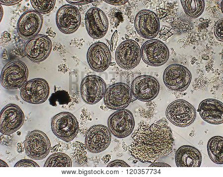Toxocara cati L-2 larvae in eggs microscope