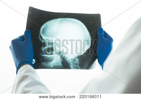 Doctor examining x-ray of the patient's skull in a medical clinic. Healthcare professional analyzing imaging test of human head.