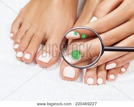 Microbes on female legs shows by mygnifying glass. Fungus concept. 3D rendering