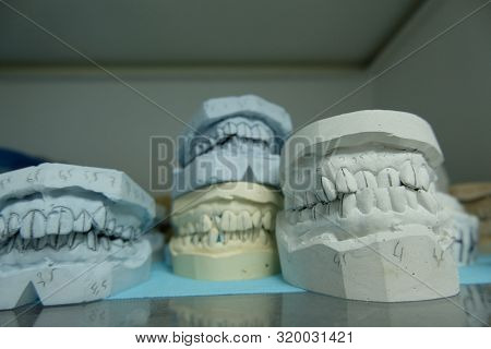Dentoforms, Dental Tooth Model In Medical Cabinet