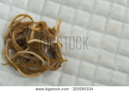 Feces With Toxocara Cati From A Stray Cat