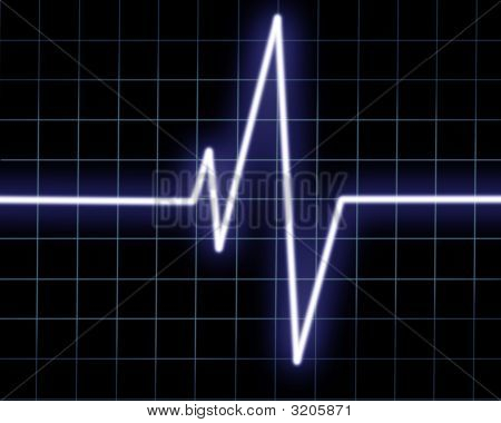 심장 박동 모니터