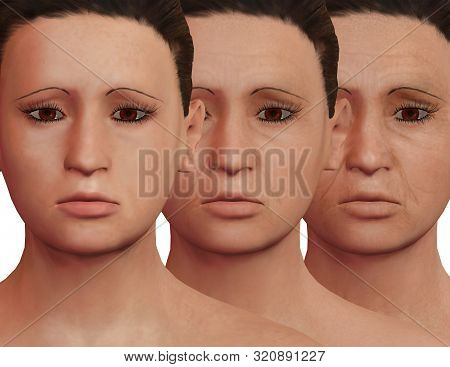 Aesthetic Process Of Rejuvenation After Prp Therapy. Facial Dermatological Treatment