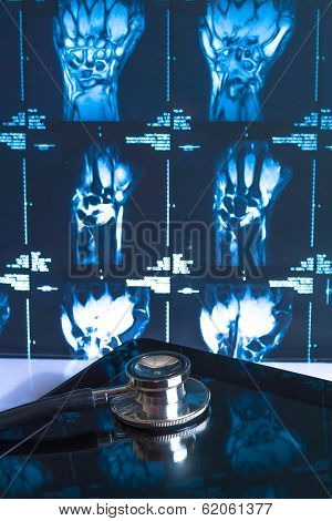 Stethoscope On Digital Tablet Pc In Laboratory On X-ray Images Background