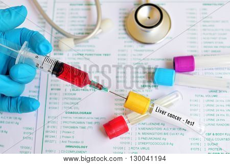 Test tube with blood sample for liver cancer test
