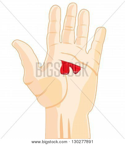 The Palm of the person with wound and blood.Vector illustration