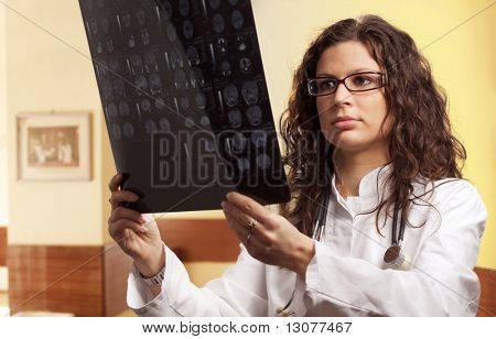 แพทย์หญิงสาวตรวจสอบ radiogram