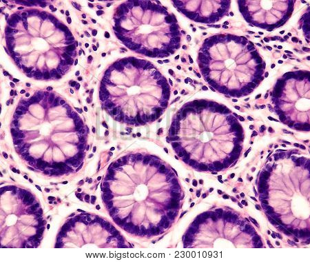 Cross Section Of Intestinal Glands (crypts Of Lieberkühn) Showing Mucous Goblet Cells. Human Colon.