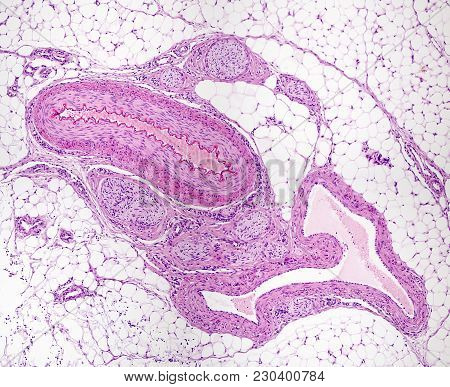 Muscular Artery, Vein And Nerve Bundles Surrounded By Adipose Tissue. The Artery Is Identified As Ha