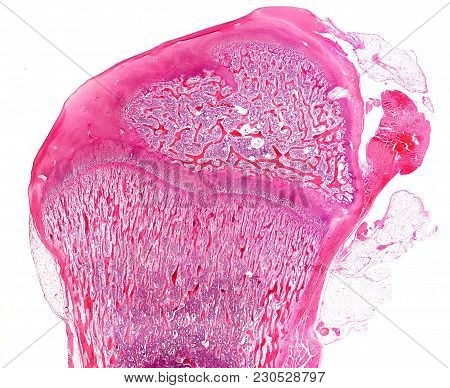 Epiphysis Of A Developing Long Bone. A Growth Plate Is Located Between The Primary (down) And Second
